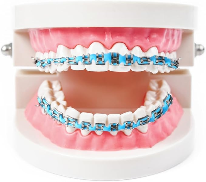 Falsos Para Dientes – Kit de Brackets Orthodontiques d’Entraînement Bleu Clair