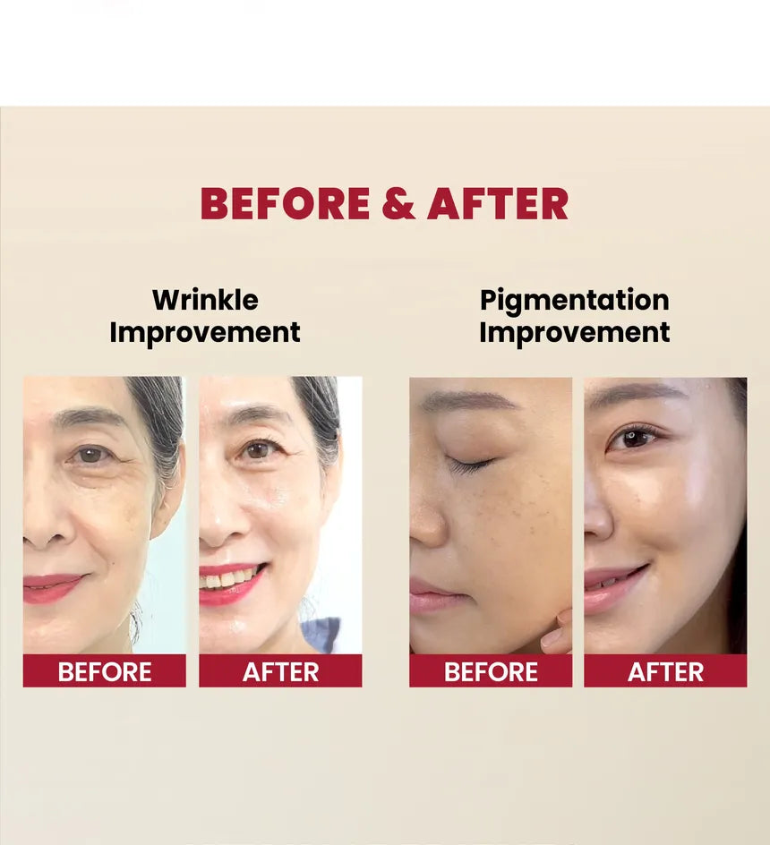 KSECRET - SEOUL 1988 Sérum anti-âge : Retinal Liposome 2% + Black Ginseng