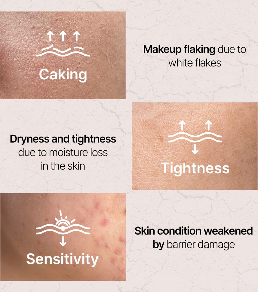 Shaishaishai – Liposome Repair Milky Cream