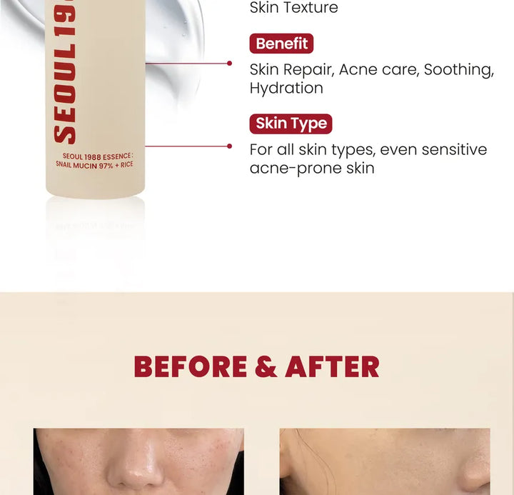 KSECRET - SEOUL 1988 Essence : Mucine d'escargot 97 % + Riz