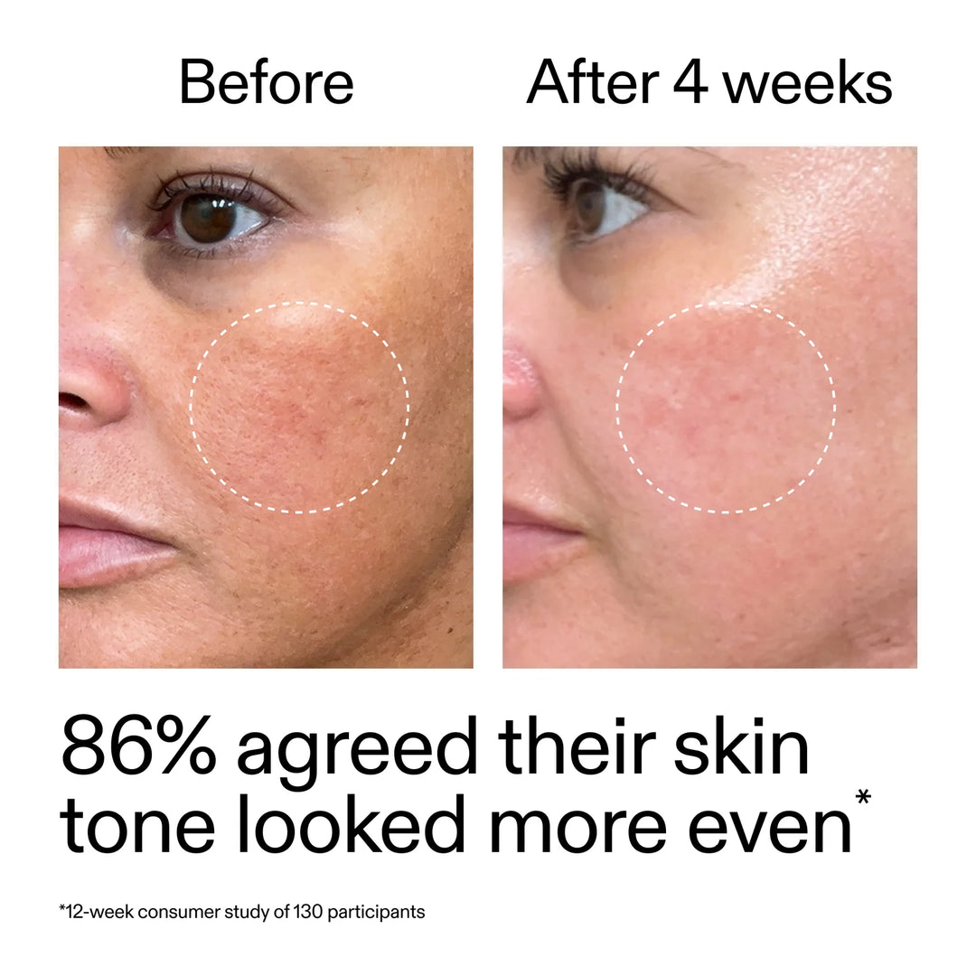 The Inkey List – Starter Retinol Serum - 30 ml