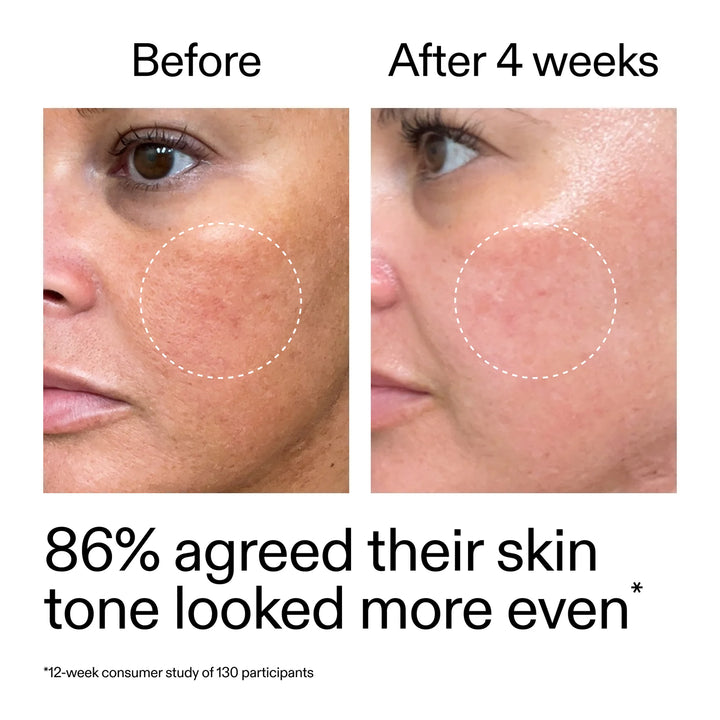 The Inkey List – Starter Retinol Serum - 30 ml